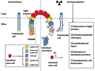 Research progress on the mechanism of radiation enteritis